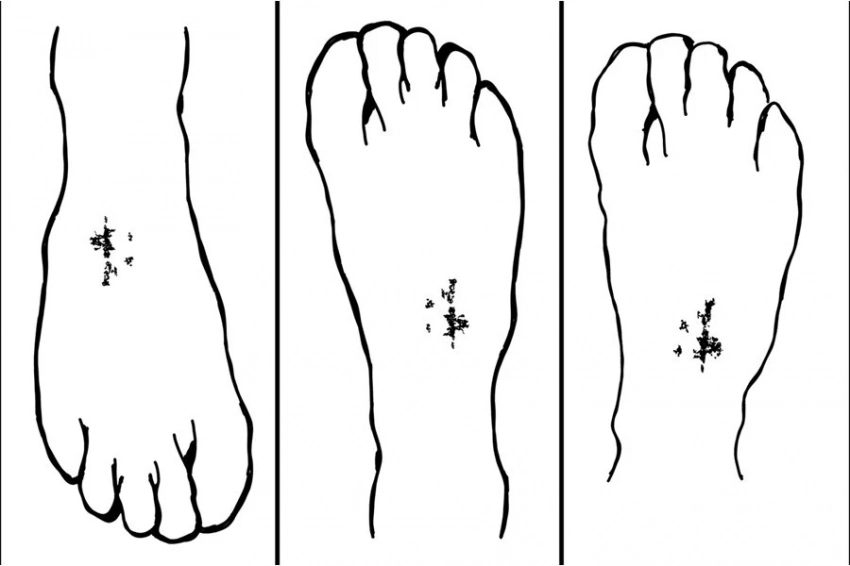 Археологи задокументировали редкую христианскую татуировку в средневековой Нубии