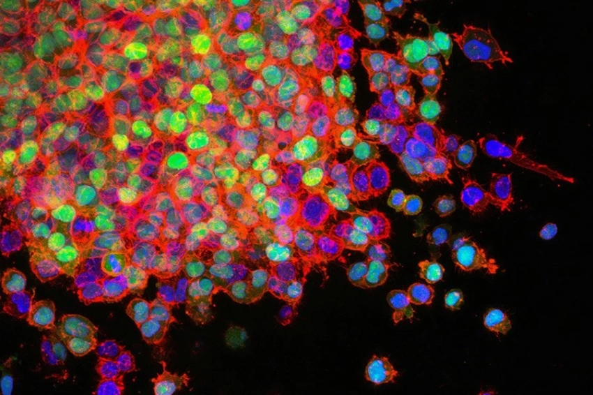 Ученые создали модифицированную бактерию, убивающую клетки рака