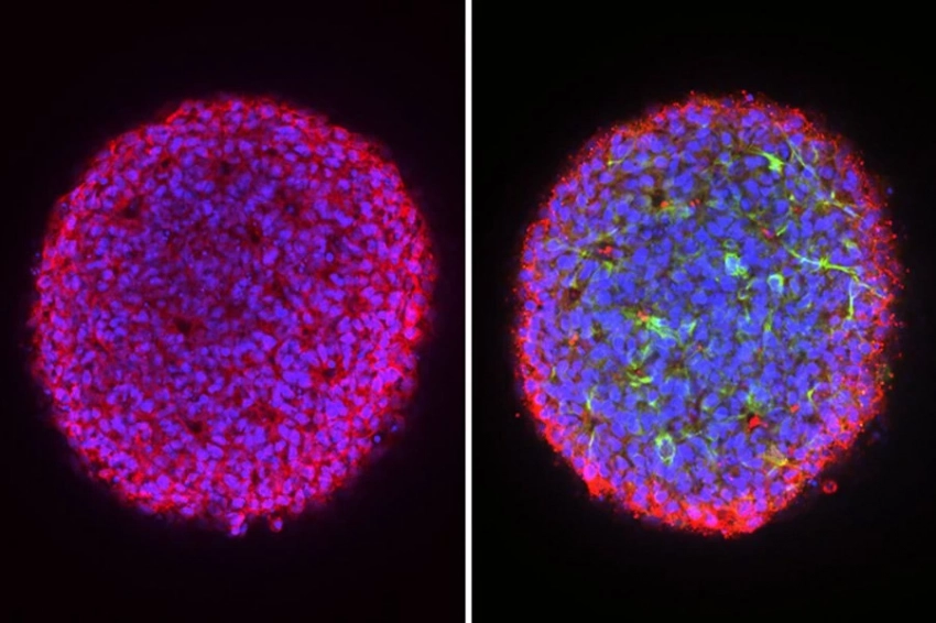 Персонализированные мини-органы могут ускорить лечение редких заболеваний